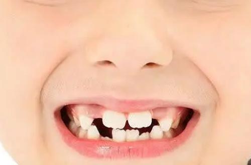 ӻ6ע
